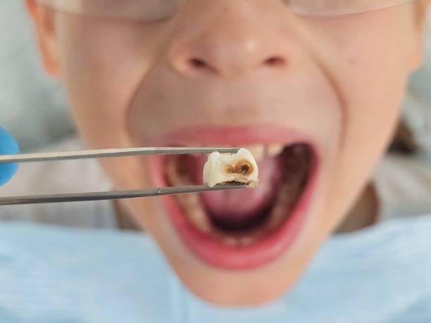 Best Emergency Treatment for Toothache in King Of Prussia, PA